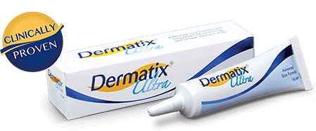Dermatix Ultra